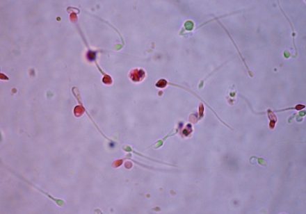 Eozyna - plemniki pod mikroskopem